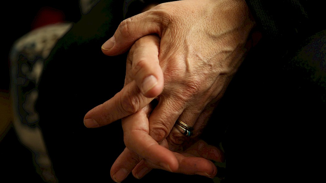 Hands with Arthritis.